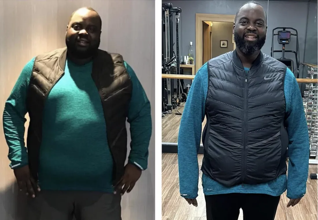 Issa Doumbia et sa lutte victorieuse contre l'obésité