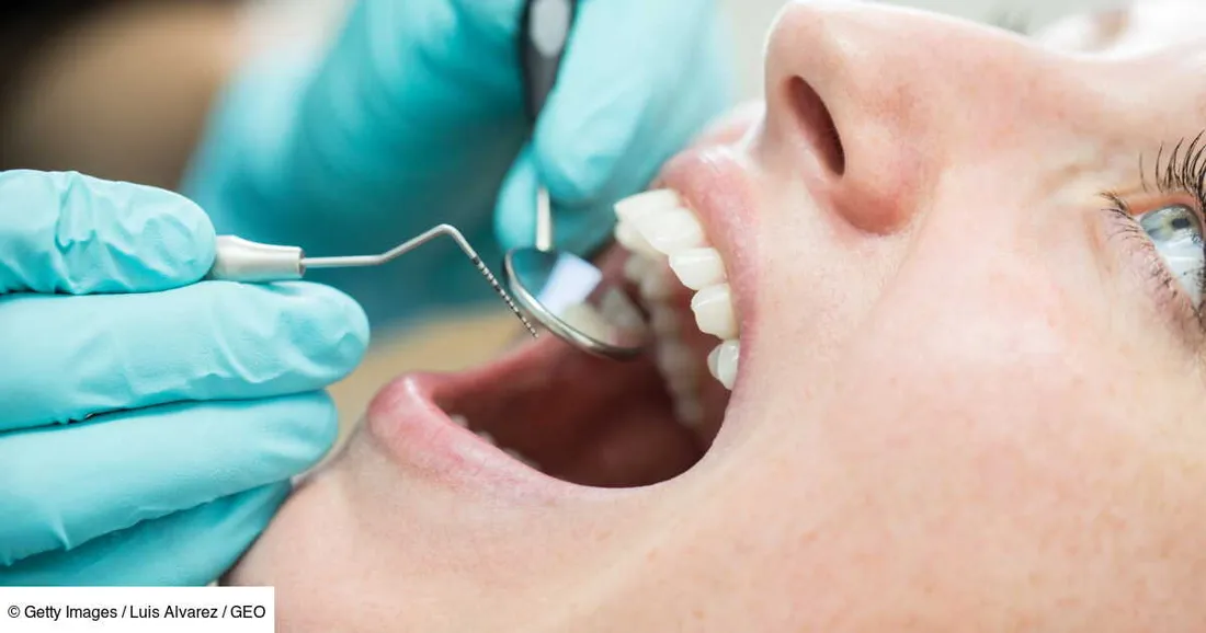 Bientôt un médicament japonais capable de faire repousser les dents