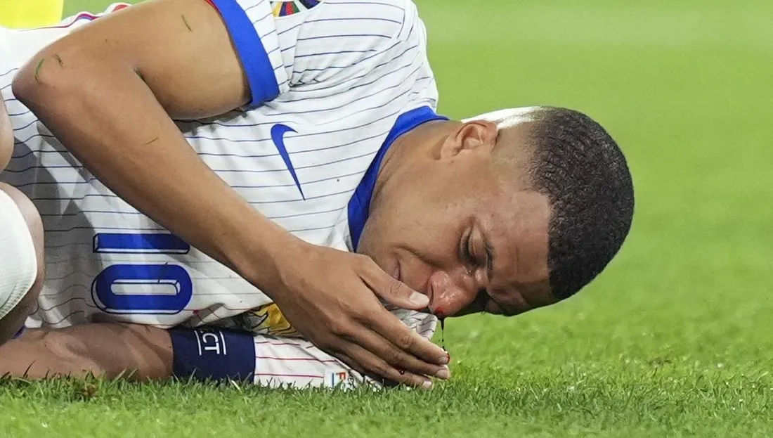 Mbappé