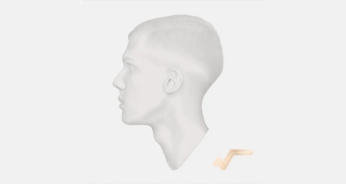 Pochette de la version collector de "Racine Carrée"