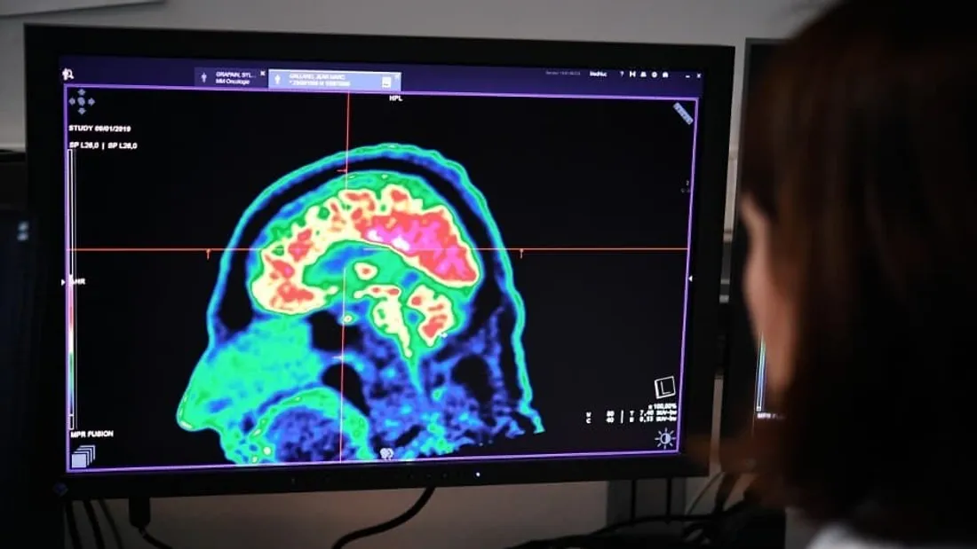 Nouvelle avancée : les ultrasons contre la dépression 