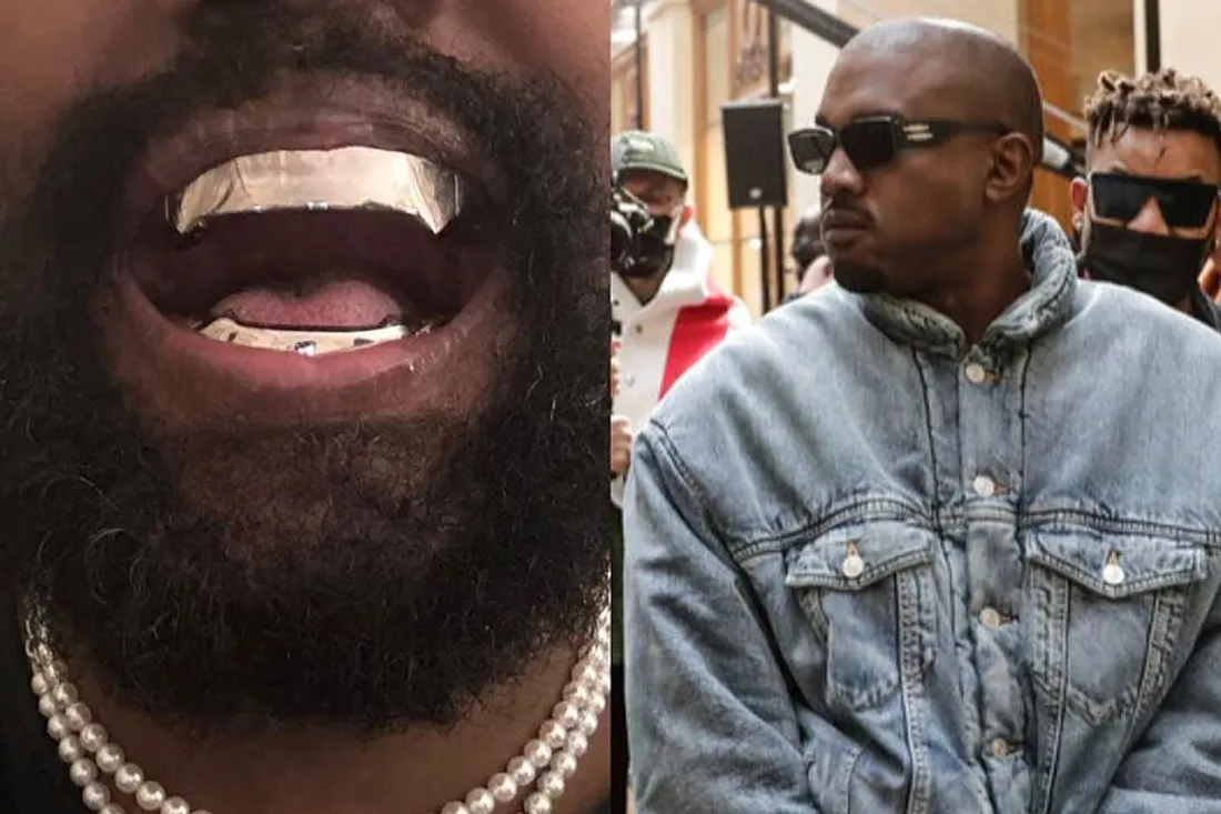 Kanye West et ses grillz en titane à 850 000 dollars