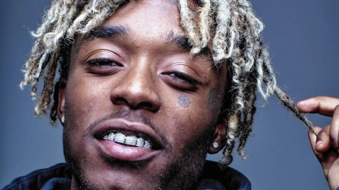 LIL UZI VERT a retiré de son front son dimant à 24 millions de dollars 