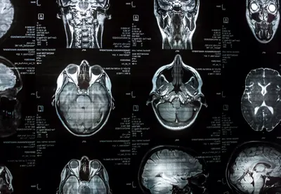 Nouvel IRM, premières images françaises