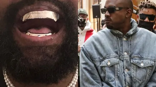 Kanye West et ses grillz en titane à 850 000 dollars