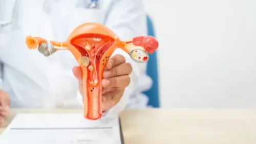 Prise en charge des tests pour l'endométriose : une « avancée...