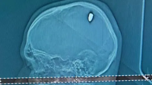 Il croyait avoir trop bu : un étudiant découvre une balle de 9mm...