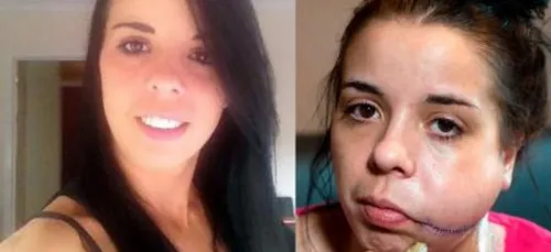 Mais pourquoi cet écossais a-t-il tailladé le visage de son ex et...