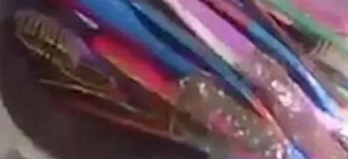 Ce mec avait 18 brosses à dents dans son estomac ! (vidéo)