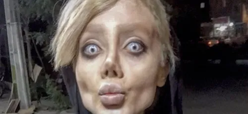 Elle entreprend 50 opérations afin de ressembler à Angelina...