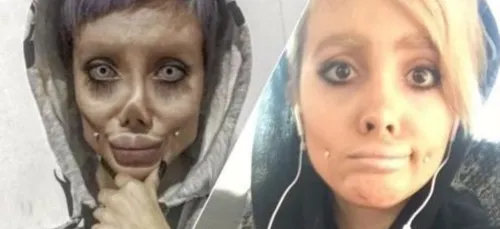 La jeune femme prête à tout pour ressembler à Angelina Jolie était...