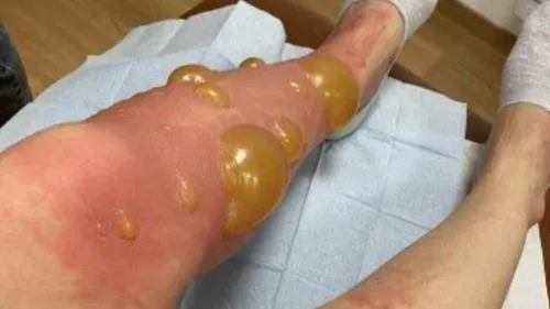 Une baignade dans un lac vire au cauchemar avec l'apparition de...