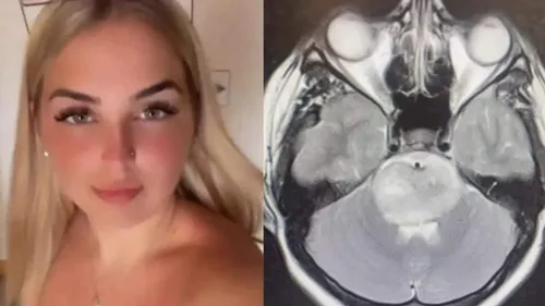 Elle pensait que c'était une gueule de bois, mais la réalité est...