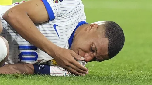 Kylian Mbappé blessé au visage : inquiétude et soutien des fans