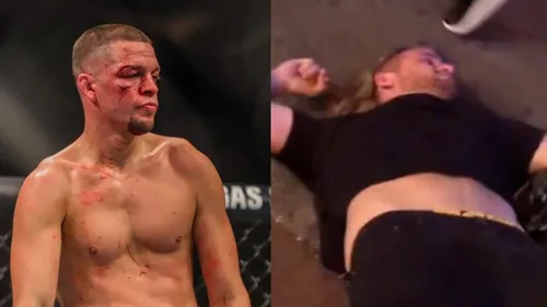 Nate Diaz recherché par la police pour agression violente en pleine...