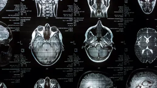 Nouvel IRM, premières images françaises