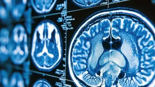 29 octobre : Journée mondiale de lutte contre l’AVC, chaque minute...