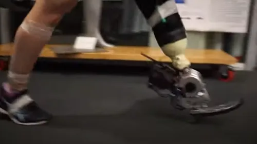 Cette prothèse, décrite comme révolutionnaire permet aux porteurs...