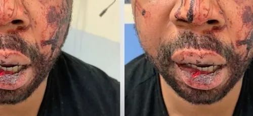 Violences policières : la bavure de trop avec des images d'une...