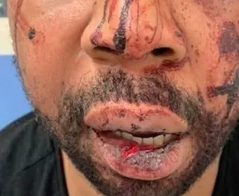 VIOLENCES POLICIÈRES : LA BAVURE DE TROP Suite, une nouvelle vidéo...