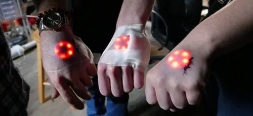 APRES LES TATOUAGES ET LES PIERCINGS  VOICI LES LED SOUS LA PEAU ...