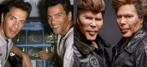 Ces hommes qui auraient du dire non à la chirurgie esthétique !...