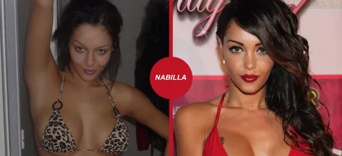 Les candidates de télé-réalité avant et après la chirurgie !...