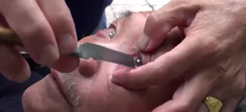 En Chine, un barbier rase le globe oculaire de ses clients. (Vidéo)