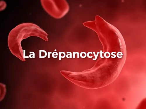 DRÉPANOCYTOSE : UNE MALADIE SOUS LES PROJECTEURS EN CE 19 JUIN