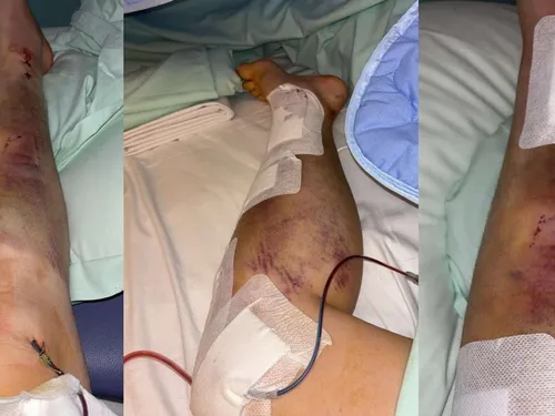 Fourmies : appel à témoins après un accident avec délit de fuite