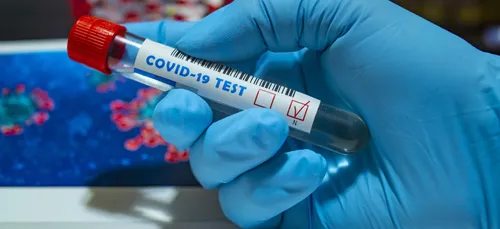 Covid-19 : des tests gratuits à Metz pendant les fêtes