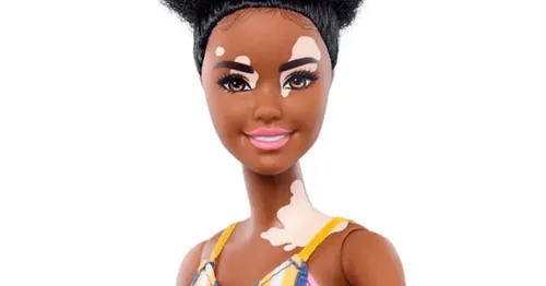 De nouvelles poupées Barbie vitiligo et sans cheveux pour stimuler...