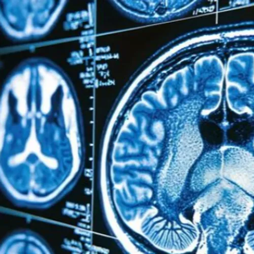 29 octobre : Journée mondiale de lutte contre l’AVC, chaque minute...