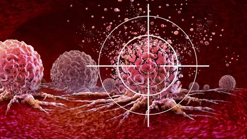 [ SANTE - FRANCE ] Une nouvelle arme contre les cancers résistants...