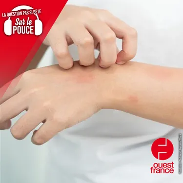 Pourquoi ne faut-il pas gratter ses piqures de moustiques ?