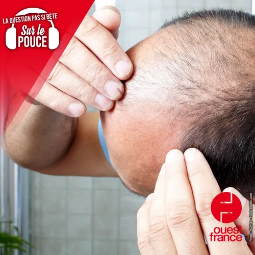 Le port de la casquette aggrave-t-il la calvitie ?