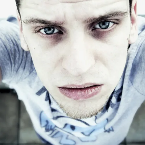 D'où viennent les cernes (et comment les atténuer) ?