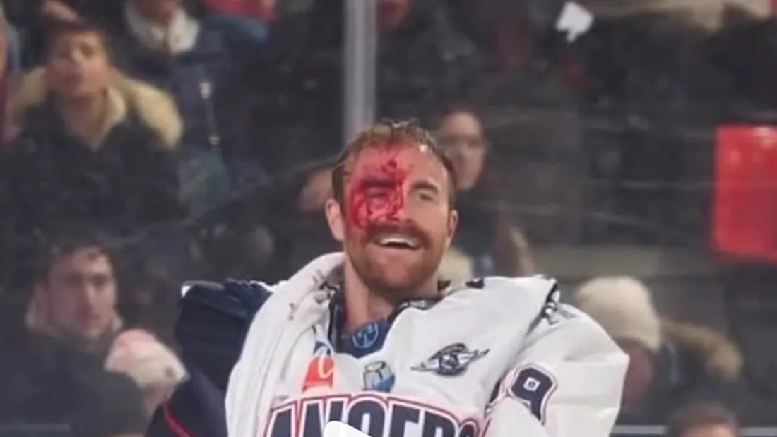 L'agression de Matt O'Connor avait nécessité 13 points de suture