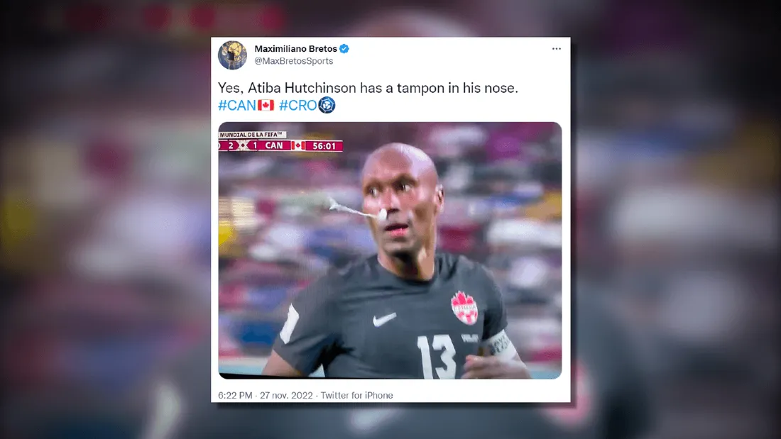 Coupe du monde : un footballeur canadien joue avec un tampon dans le nez
