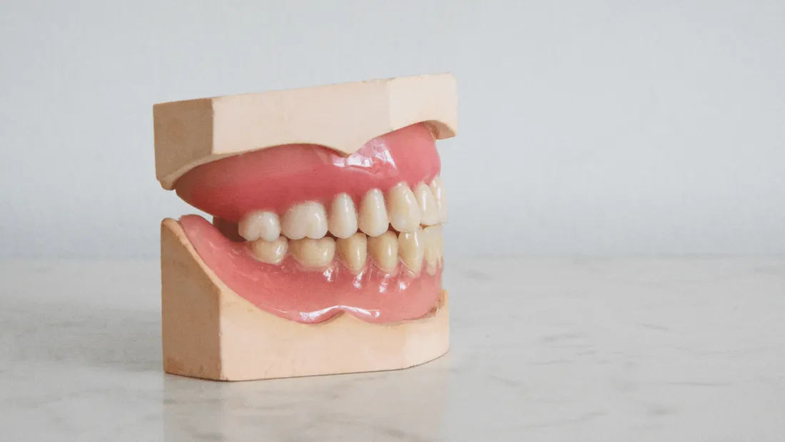 Il retrouve son dentier 11 ans après l'avoir perdu lors de ses vacances