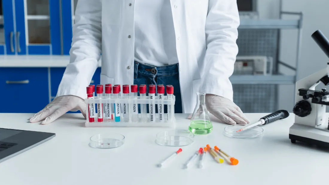 Epidémie variole du singe