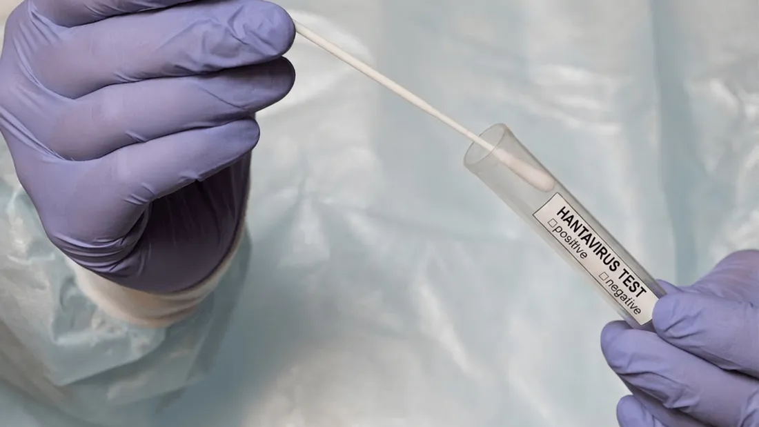 Hantavirus test