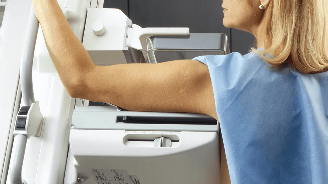 Mammographie