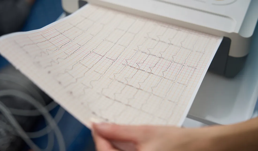 La terre a de nouveau tremblé cette nuit dans le Finistère.