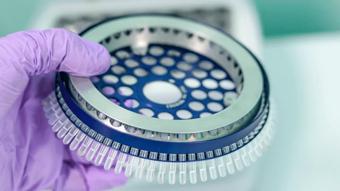 Belgique : un laboratoire confond résultats négatifs et positifs