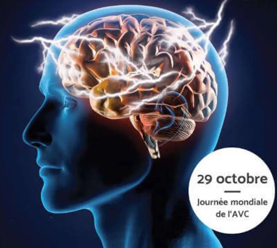 Journée mondiale de l'AVC