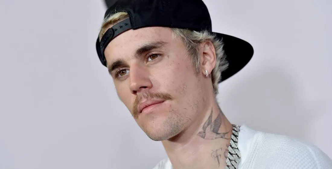 Justin Bieber souffre d'une paralysie du visage