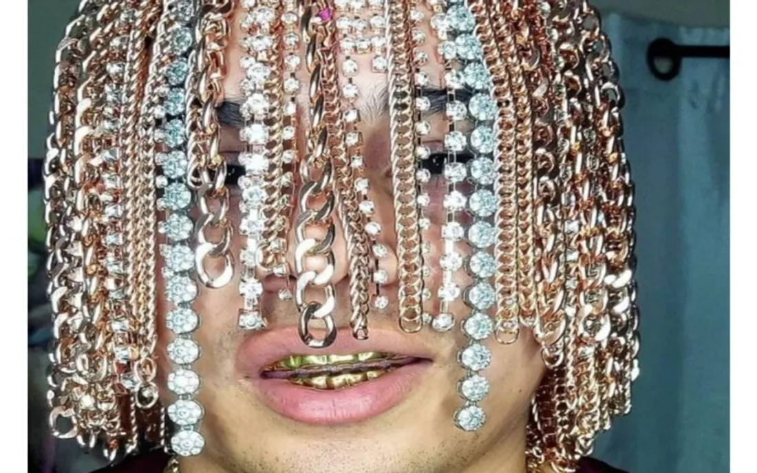 Dan Sur s'est fait implanter des chaines en or sur le crâne