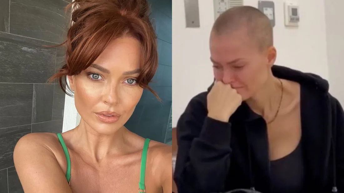 Caroline Receveur partage l'une des rares photos d'elle avec sa chimio