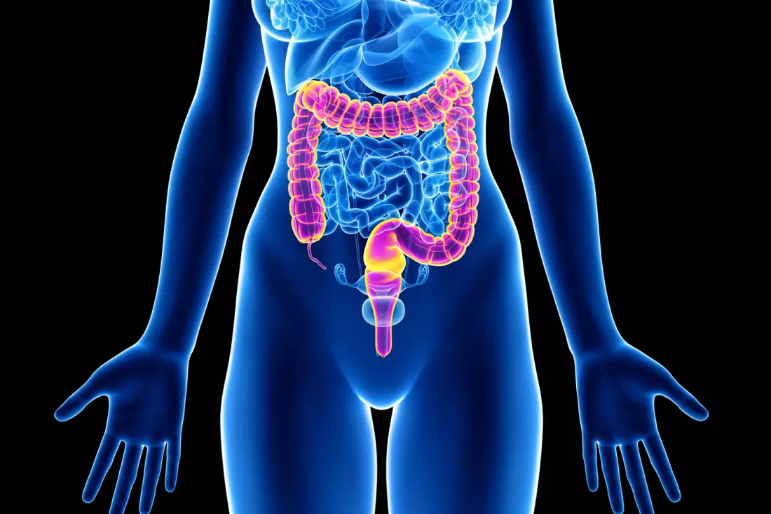 Augmentation des cancers du côlon chez les jeunes